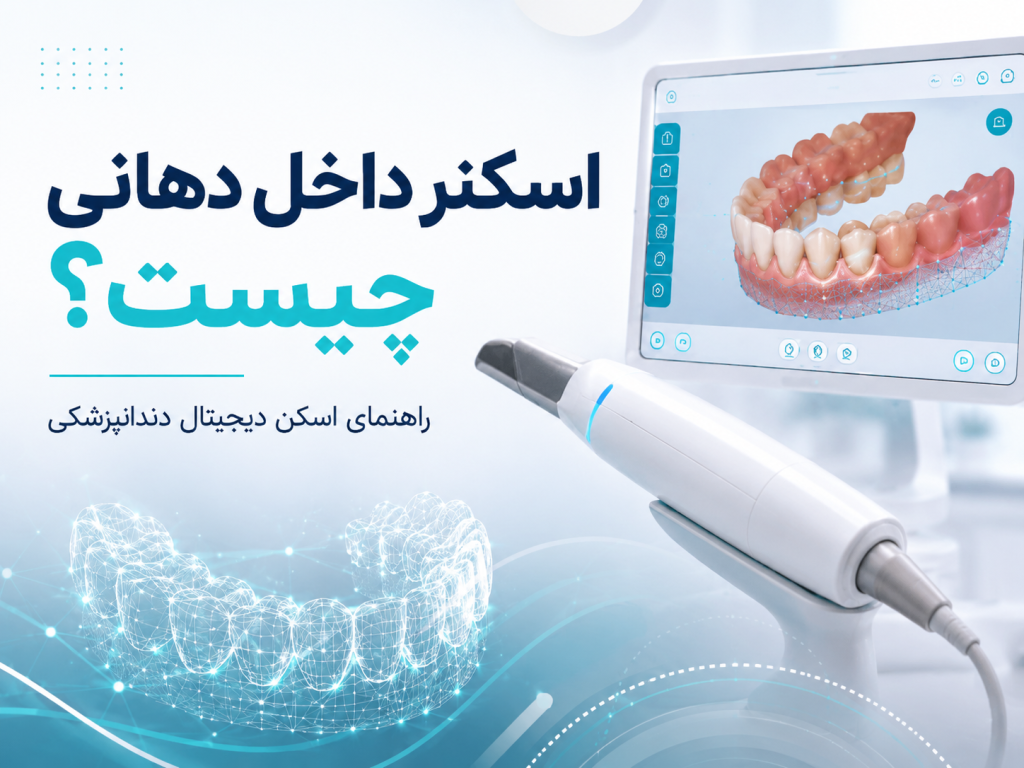 اسکنر داخل دهانی